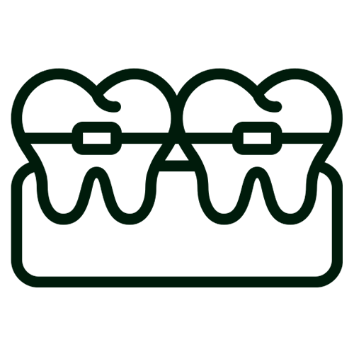 Alinhamos dentes e corrigimos a mordida com aparelhos modernos e discretos. Buscamos estética, saúde e conforto, oferecendo resultados estáveis que trazem equilíbrio ao sorriso e confiança. Trabalhamos com o sistema Ertty, alinhadores invisíveis como Invisalign e fixações rígidas para correção mais rápida e eficaz. Também realizamos ortodontia preparatória para tratamento ortocirúrgico em casos de ortognática.